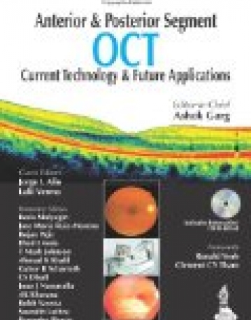 Anterior and Posterior Segment OCT: Current Technology and Future Applications