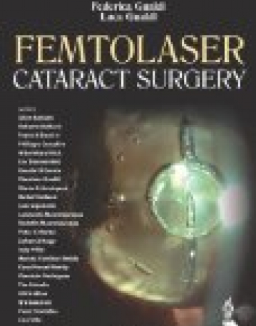 Femtolaser Cataract Surgery