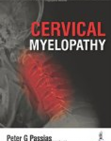 Cervical Myelopathy