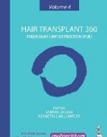 Hair Transplant 360: Volume 4