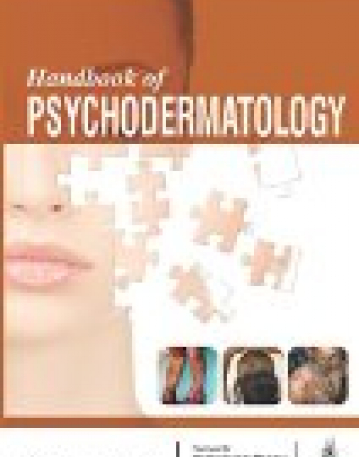 Handbook of Psychodermatology