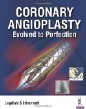 Coronary  Angioplasty  Evolved to Perfection